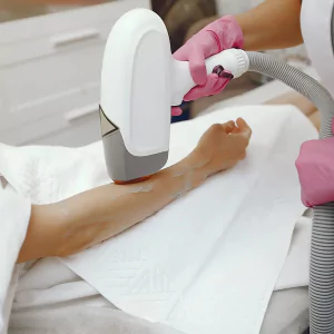 Permanent Hair Removal Laser